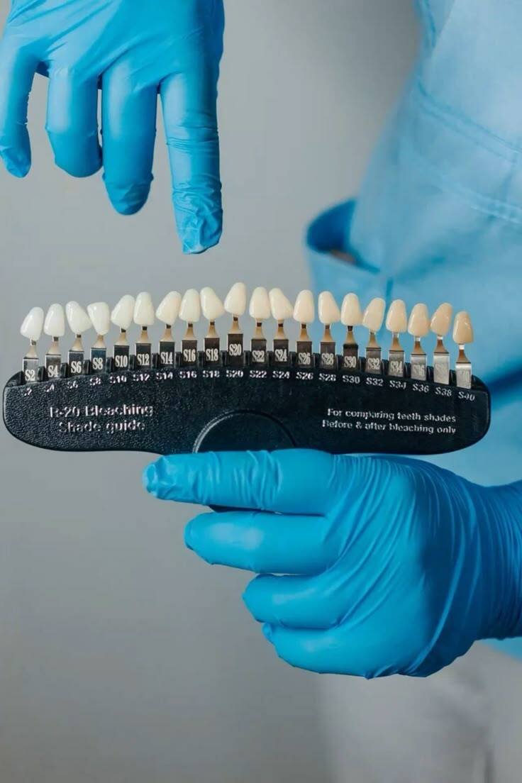Teeth Whitening